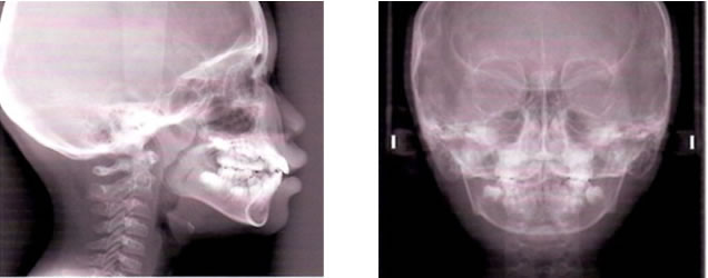 頭部X線規格写真撮影イメージ